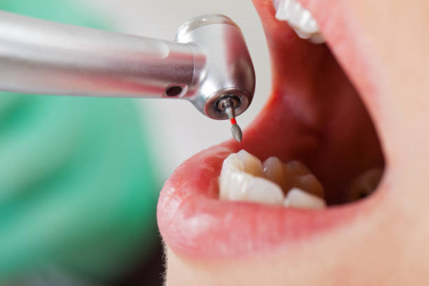 Best Broken or Chipped Tooth Repair in Enlow, PA